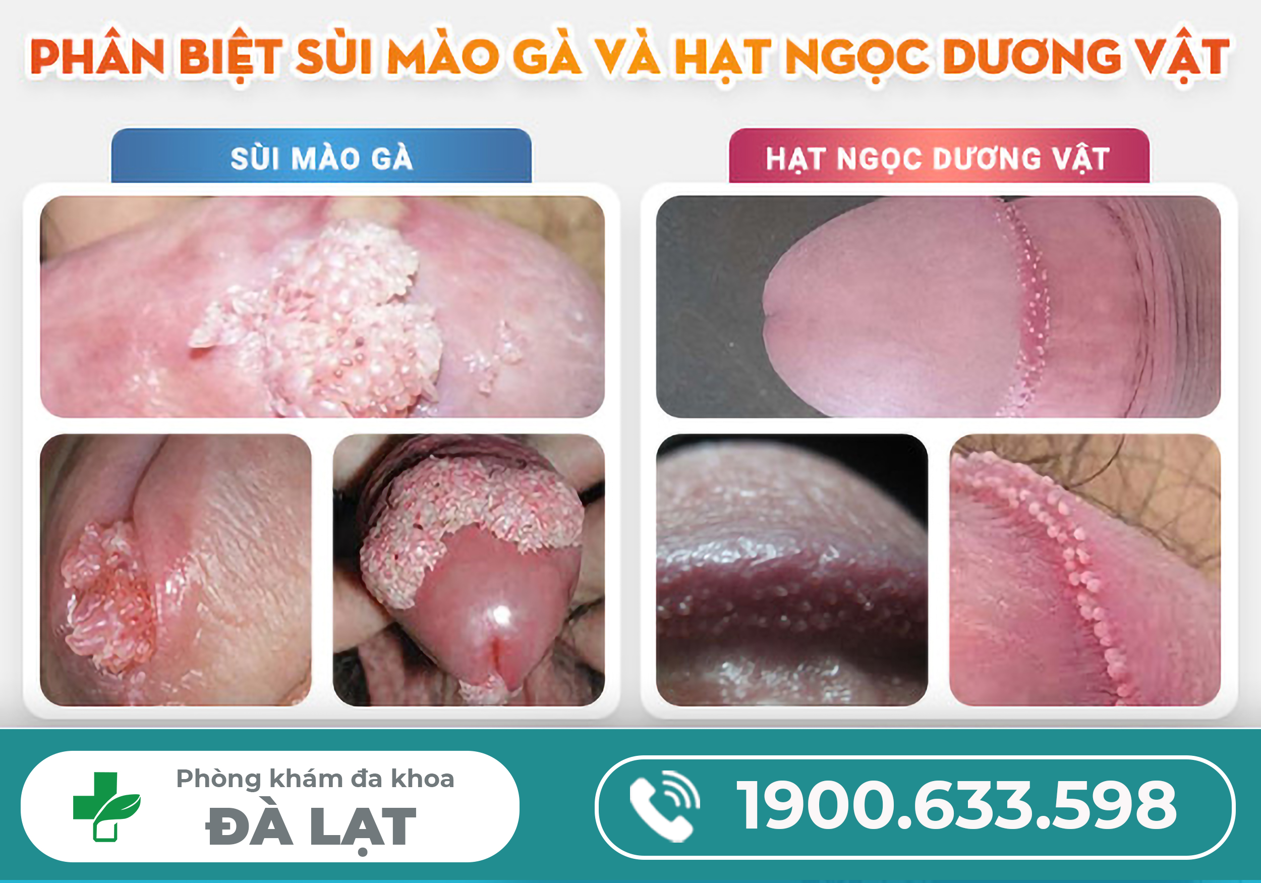 Hình ảnh minh họa